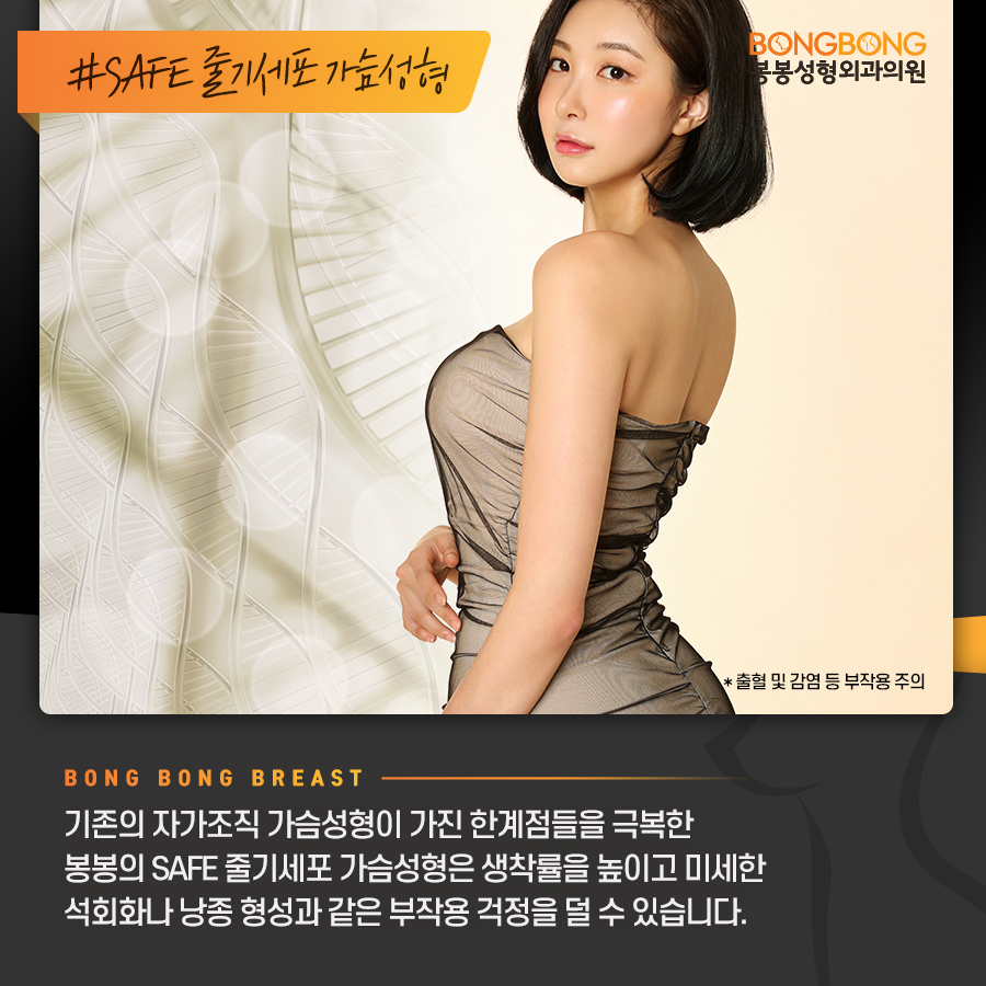 나에게 가장 어울리는 가슴성형을 위한 체크 포인트는? 관련 이미지 6