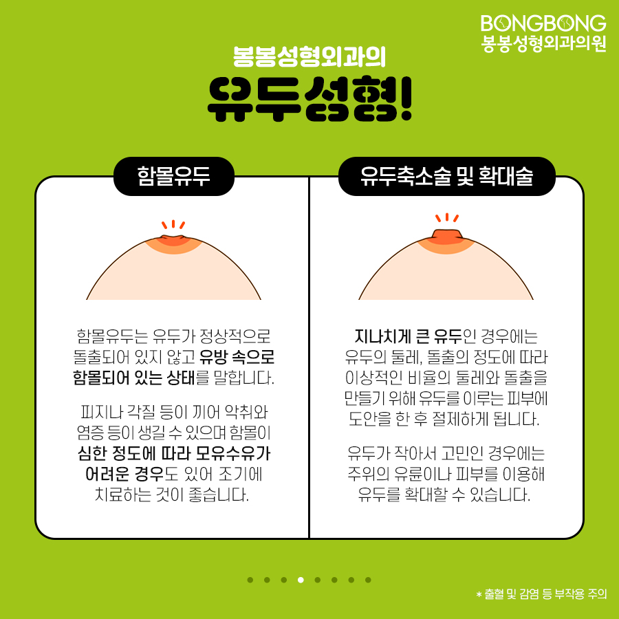 아름다움의 완성, 유두성형/유륜성형이란!? 관련 이미지 6
