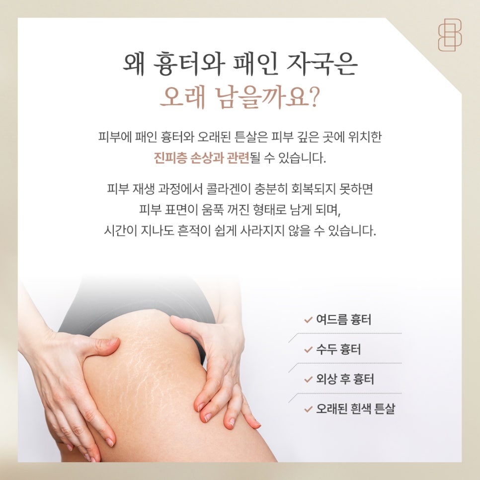 미라젯 흉터 케어 가이드 오래된 패인 자국 진피층 재생으로 말끔하게 관련 이미지 2