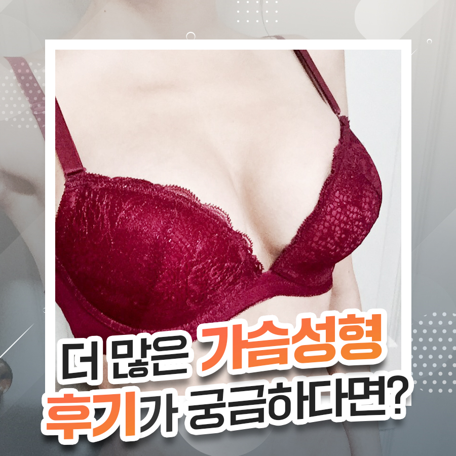 가슴재수술, 어떤 가슴보형물로 괜찮을까? 관련 이미지 10