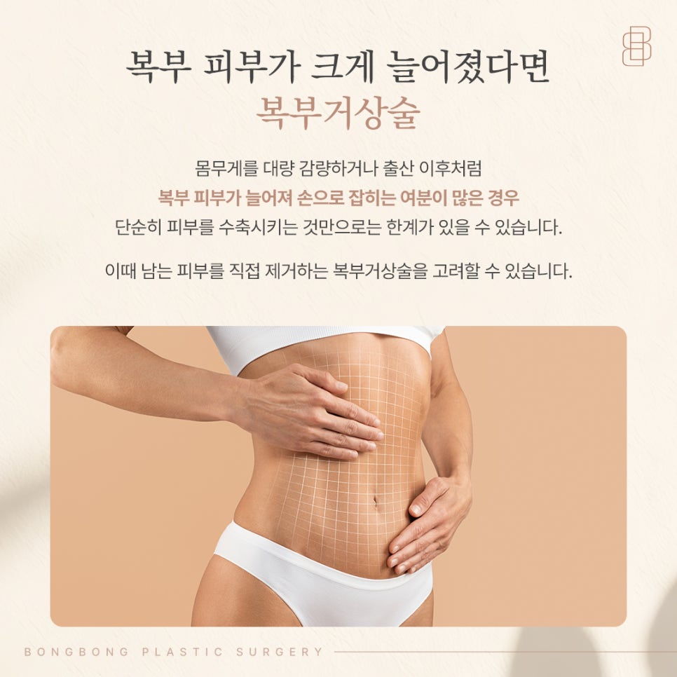 리뉴비온 vs 복부거상술, 처짐 정도에 따라 고르는 기준 관련 이미지 3