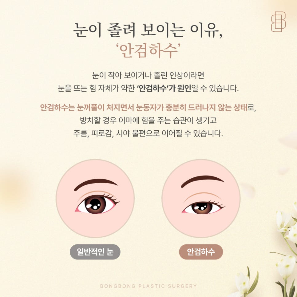 Ptosis Eye-Shape Correction Methods: What Is the Difference Between Incisional and Non-Incisional Techniques? image 6