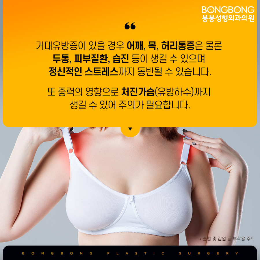 가슴축소수술후기 후회없는 선택을 위해 관련 이미지 3