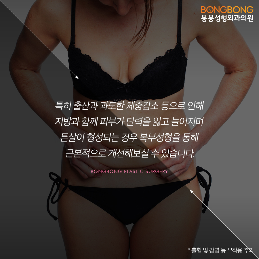 복부성형수술, 트고 늘어진뱃살 개선에 탁월해 관련 이미지 2
