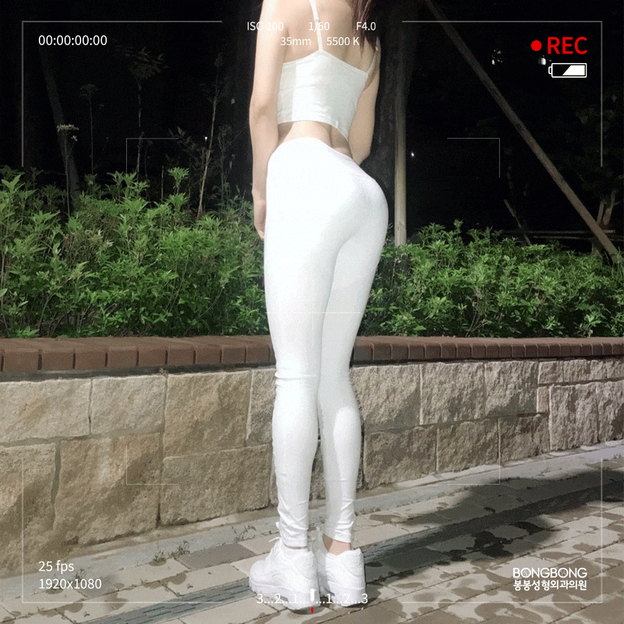 #허벅지지방흡입으로 #하체비만콤플렉스 종결! ft.봉봉성형외과 관련 이미지 12