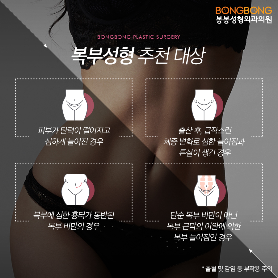 다이어트후 뱃살 처짐 고민.. 봉봉성형외과 어때? 관련 이미지 3