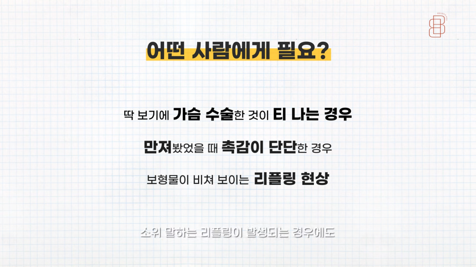 티 안나는 자연스러운 가슴성형 원한다면 바이볼 고려! 관련 이미지 3