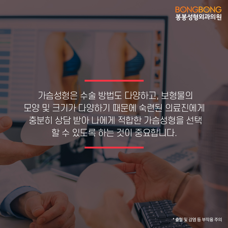안전한 가슴보형물, 모티바 - 봉봉성형외과에서 알아보자 관련 이미지 2