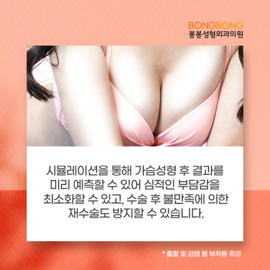 가슴성형 후 결과 미리보기? 봉봉 3차원 진단 프로세스! 관련 이미지 4