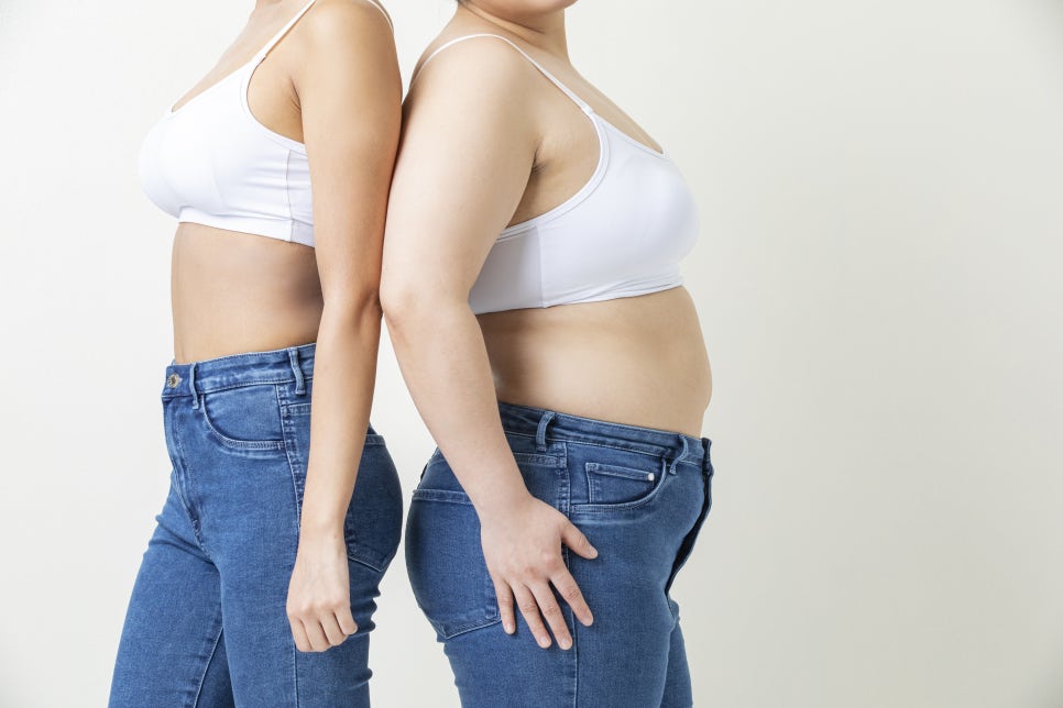미니복부거상 비용은 어떻게 결정될까요, 선택 전 체크 포인트 관련 이미지 5