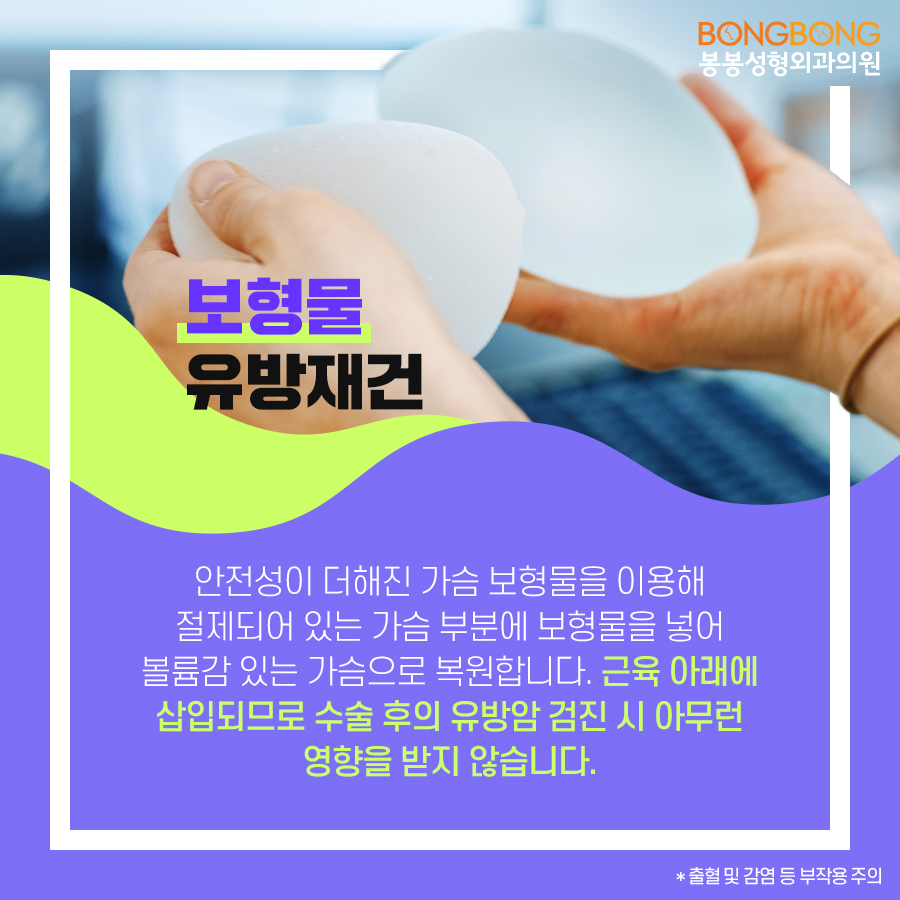 유방재건술 방법은 어떤 것이 있나요? 관련 이미지 6