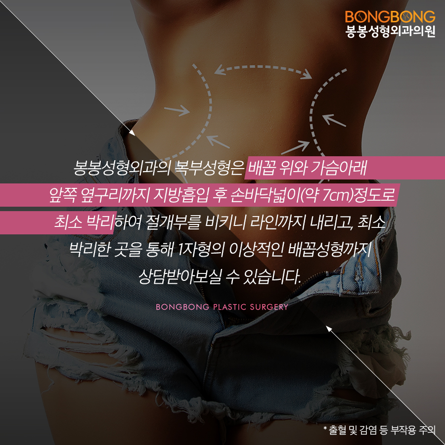 탄력잃은 뱃살 고민, 봉봉성형외과 복부성형으로 해결~ 관련 이미지 5
