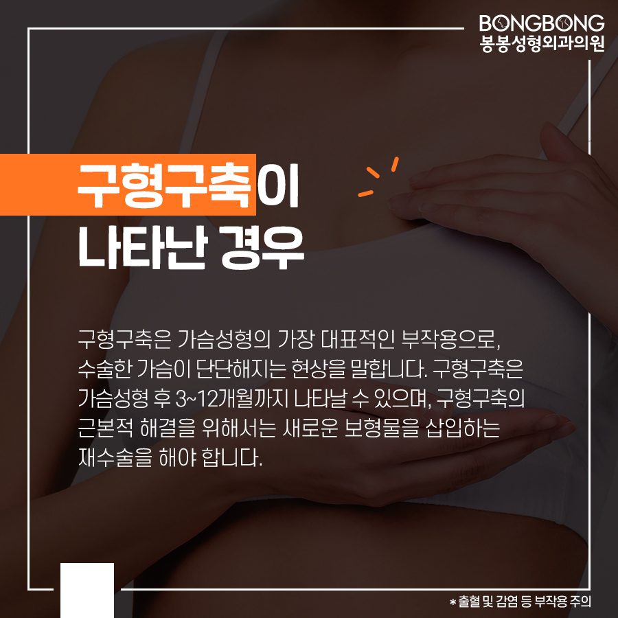 가슴재수술 시 보형물제거가 필요한 경우는? 관련 이미지 4