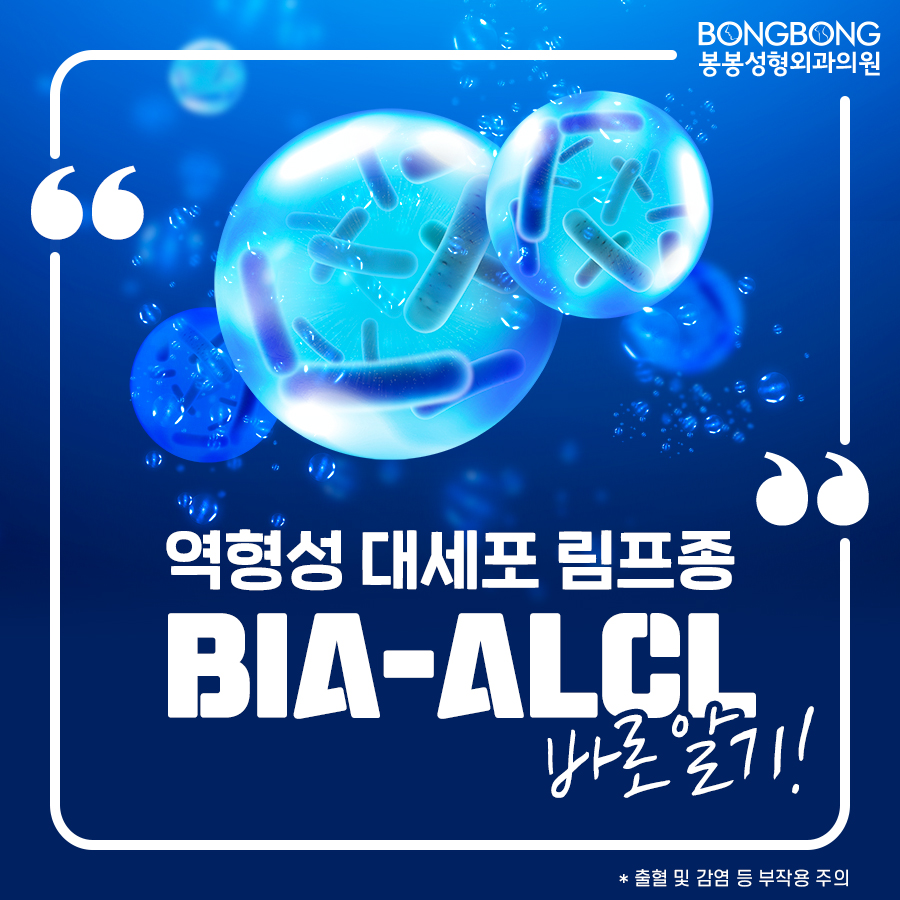 앨러간 보형물 가슴성형 후 BIA-ALCL 희귀암? 바로알기 관련 이미지 1