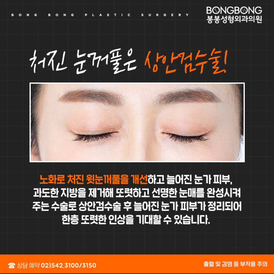 어버이날 효도성형, 상하안검수술 어디가 좋을까? 관련 이미지 4