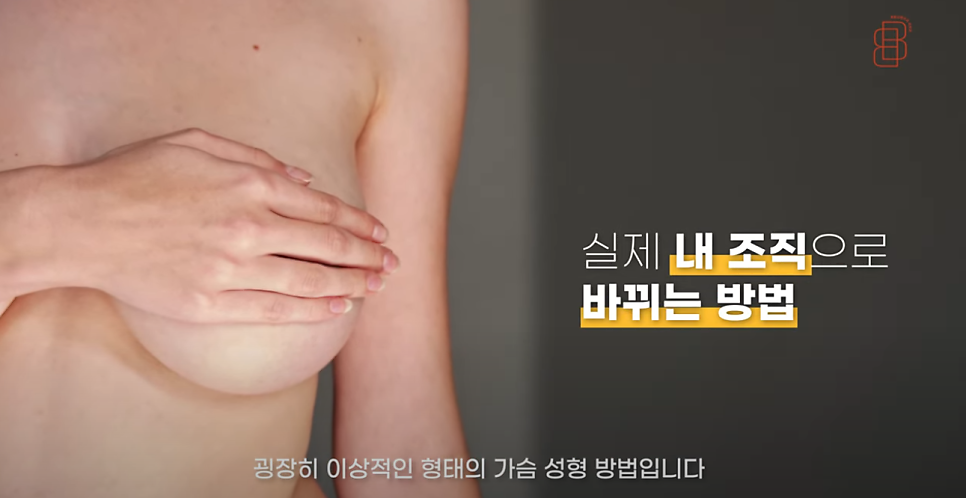 [봉봉성형외과] 생체적합성이 높은 재료를 이용한 관련 이미지 5
