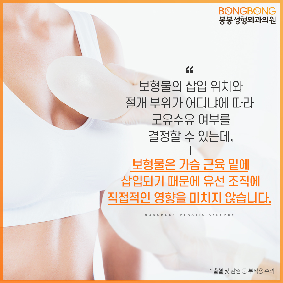 출산후 처진가슴으로 인한 고민, 가슴성형 후 모유수유 가능할까? 관련 이미지 4
