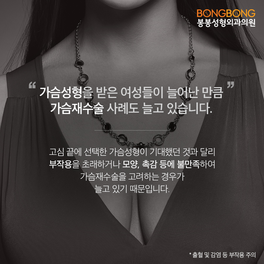 가슴보형물제거 및 가슴재수술유명한곳 다들 여기를 극찬하더라! 관련 이미지 2