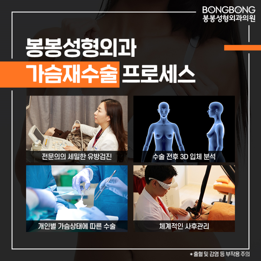 가슴성형 후 구형구축 [가슴재수술] 고려사항은? 관련 이미지 7