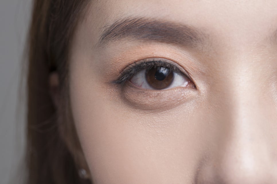 눈쌍커풀수술 매몰법 절개법 차이점이 궁금해요 관련 이미지 6