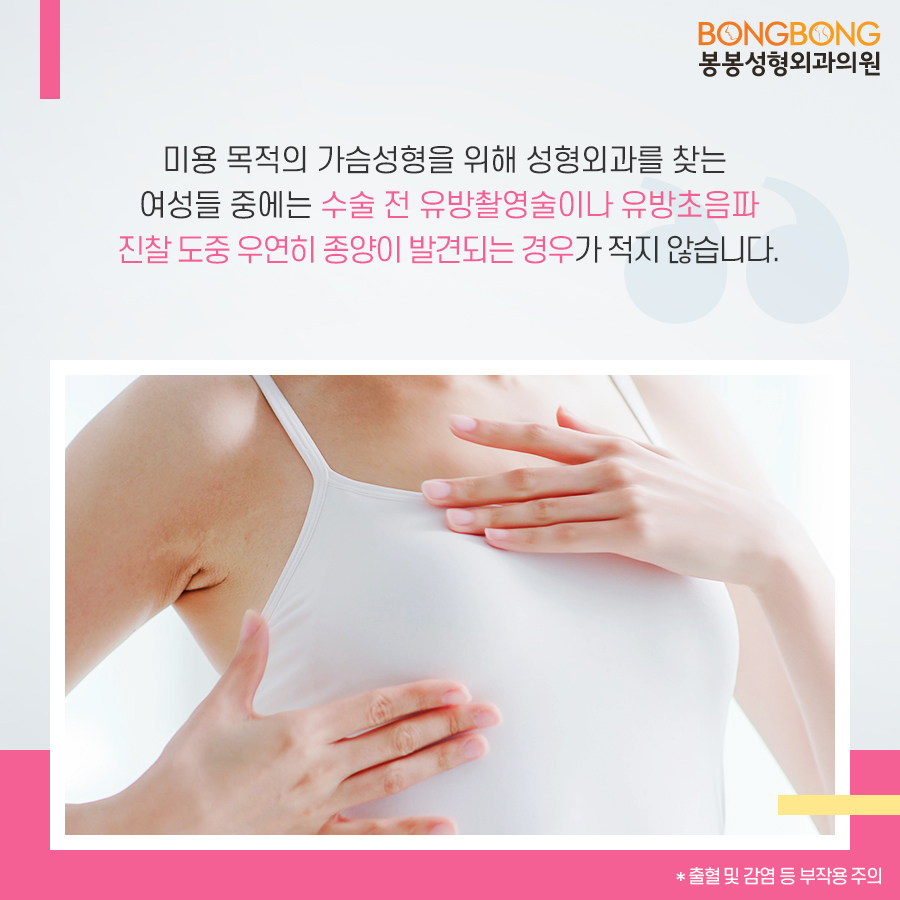 유방초음파검사, 암검진을 성형외과에서? 관련 이미지 3