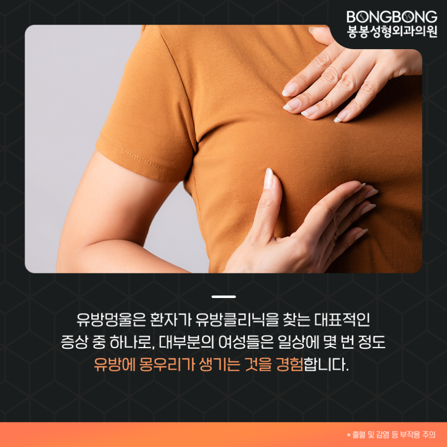 유방초음파로 가슴멍울 및 유방양성질환 살펴보자! 관련 이미지 2