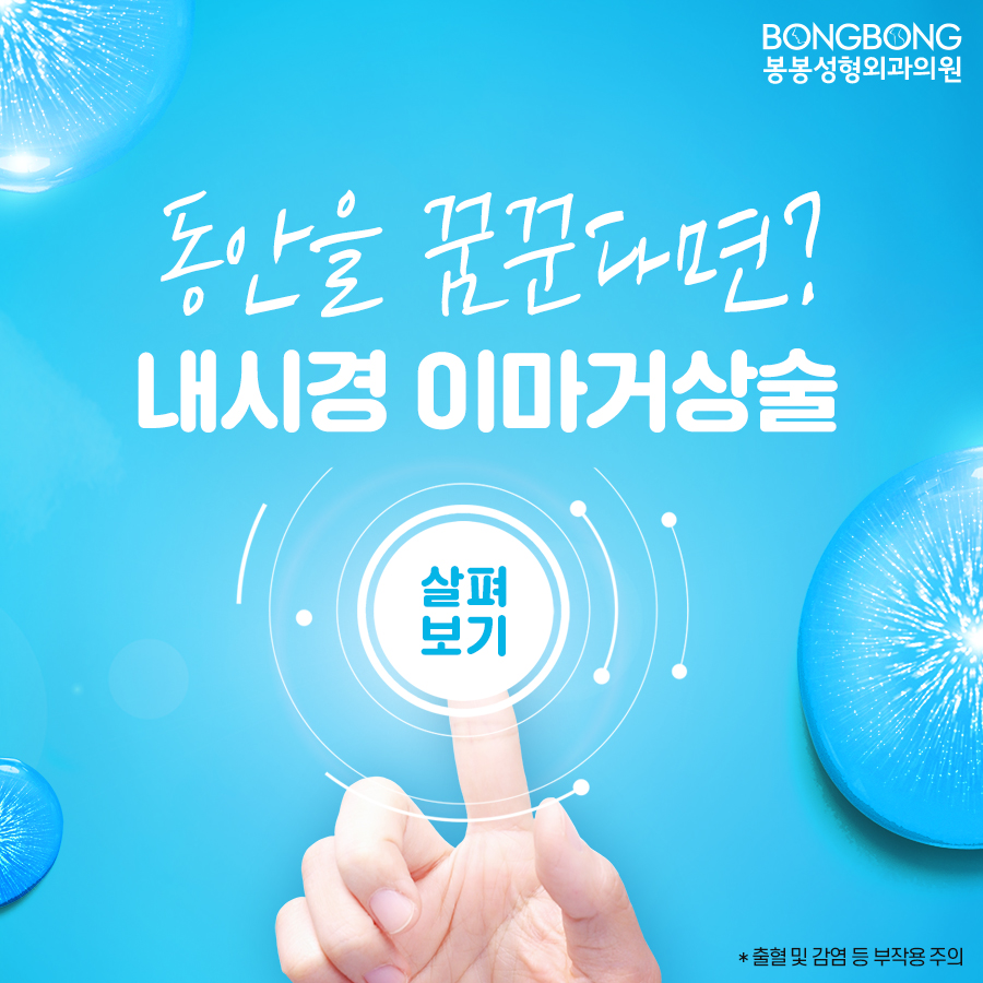 내시경이마거상술 효과는? 관련 이미지 1