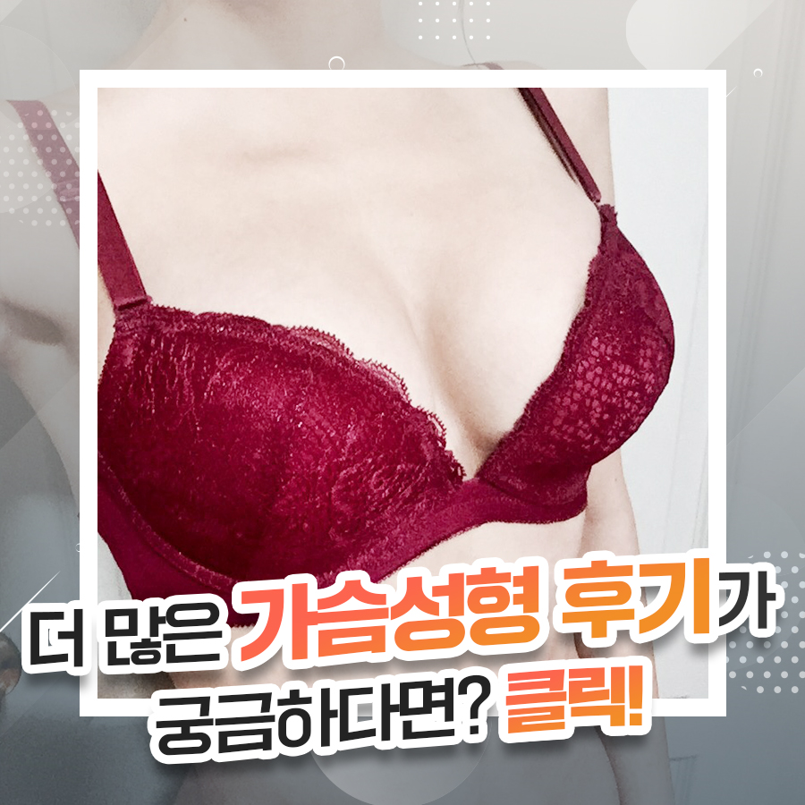 윗가슴 볼륨까지 고려한 가슴확대수술! 관련 이미지 10