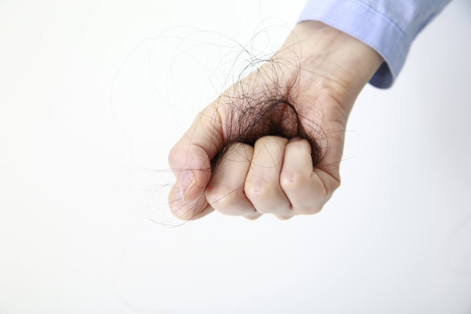 하루 머리카락 100개 이상 빠진다면 탈모증상? 관련 이미지 4