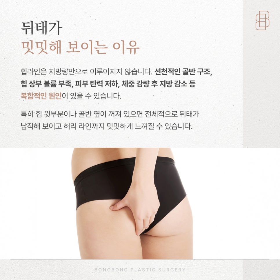 Correction of Hip Dips and Ways to Enhance a Flat Pelvic Line: Hip Augmentation Surgery image 2