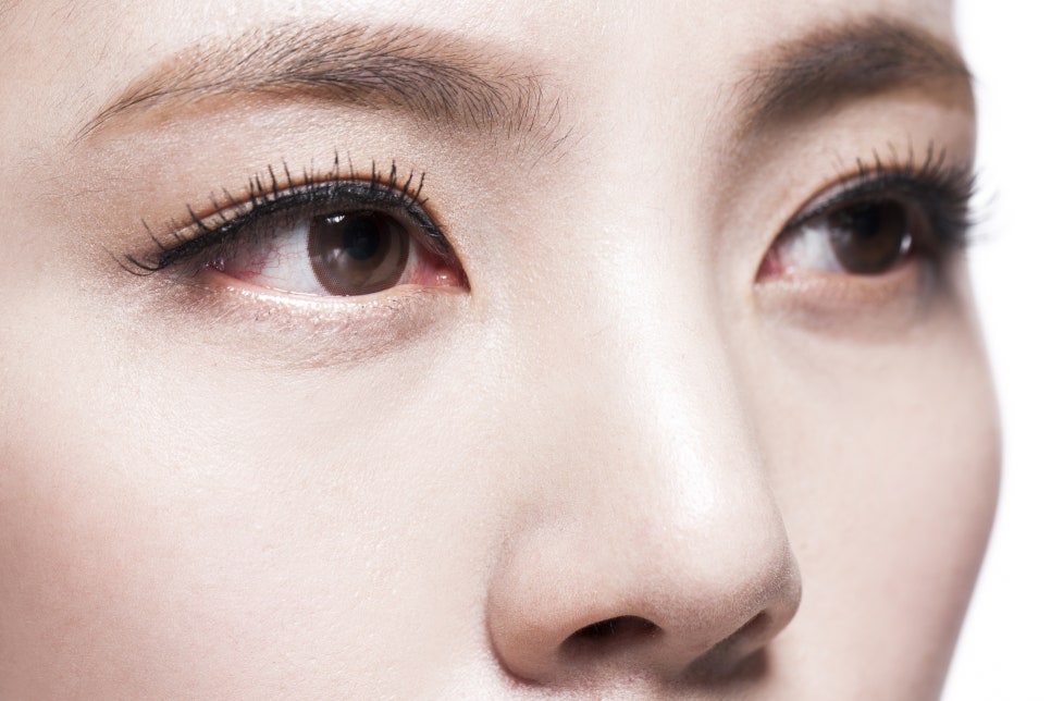 How to Measure Midface Proportions: How to Make a Long Face Look Shorter image 4