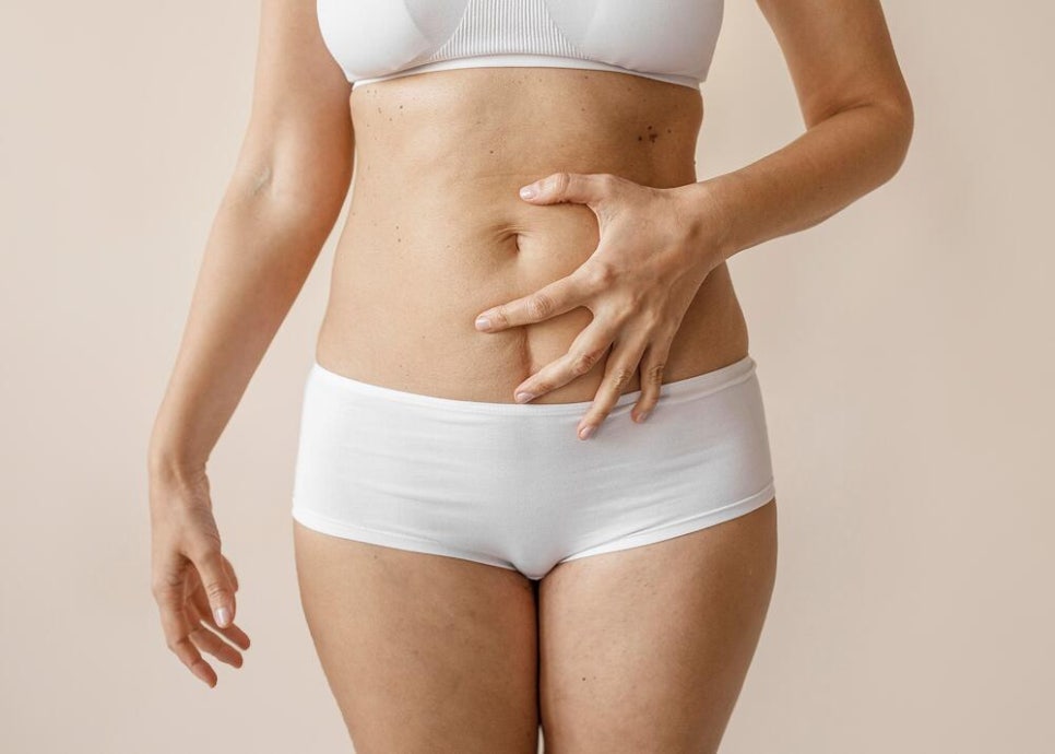 운동해도 처진 뱃살, 왜 그대로일까요? 복부성형이 고려되는 순간 관련 이미지 10