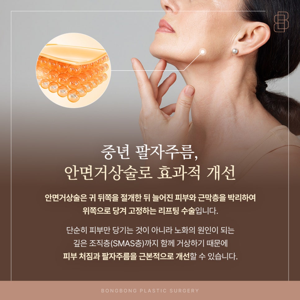 중년안면거상술 얼굴 팔자주름을 없애는법 가능할까? 관련 이미지 4
