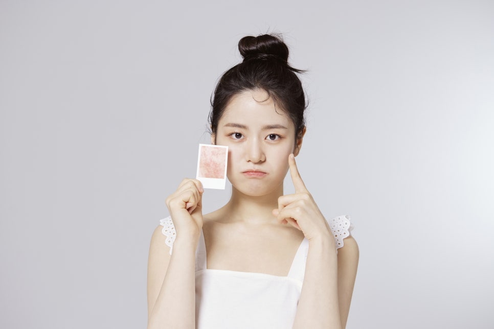 피부 노화 방지 방법, 홈케어 말고 더 좋은 것은?! 관련 이미지 1