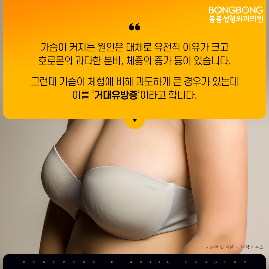 가슴축소수술후기 후회없는 선택을 위해 관련 이미지 2