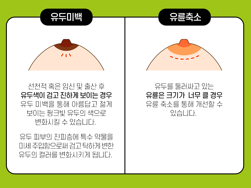 이상적 가슴을 완성하는 관련 이미지 5