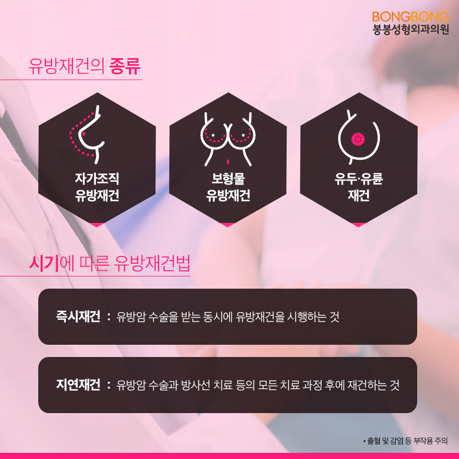 유방암수술후 가능한 유방재건술 종류 및 방법 A to Z 관련 이미지 3