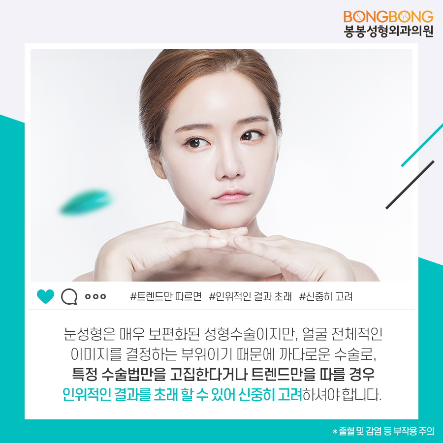 눈성형종류 중 내게 맞는 것 봉봉성형외과 관련 이미지 3