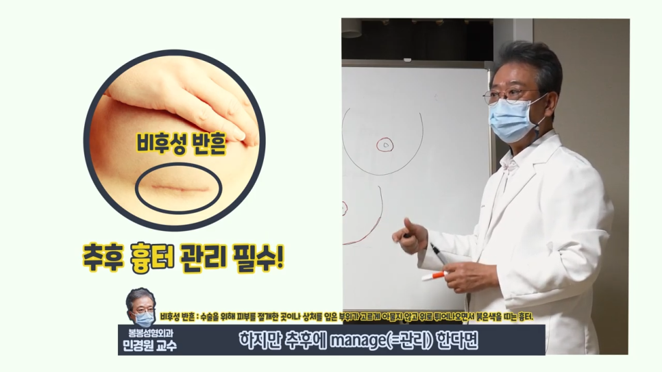 가슴축소수술후기 보니 절개 방법이 3가지던데 관련 이미지 6