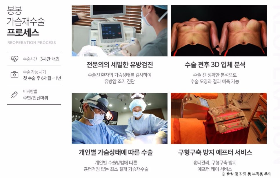 가슴재수술잘하는곳 모티바가슴성형이 좋다고? 관련 이미지 5