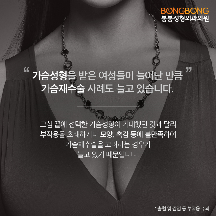 가슴재수술, 모티바 보형물이 효과적일까? - 봉봉성형외과 관련 이미지 3