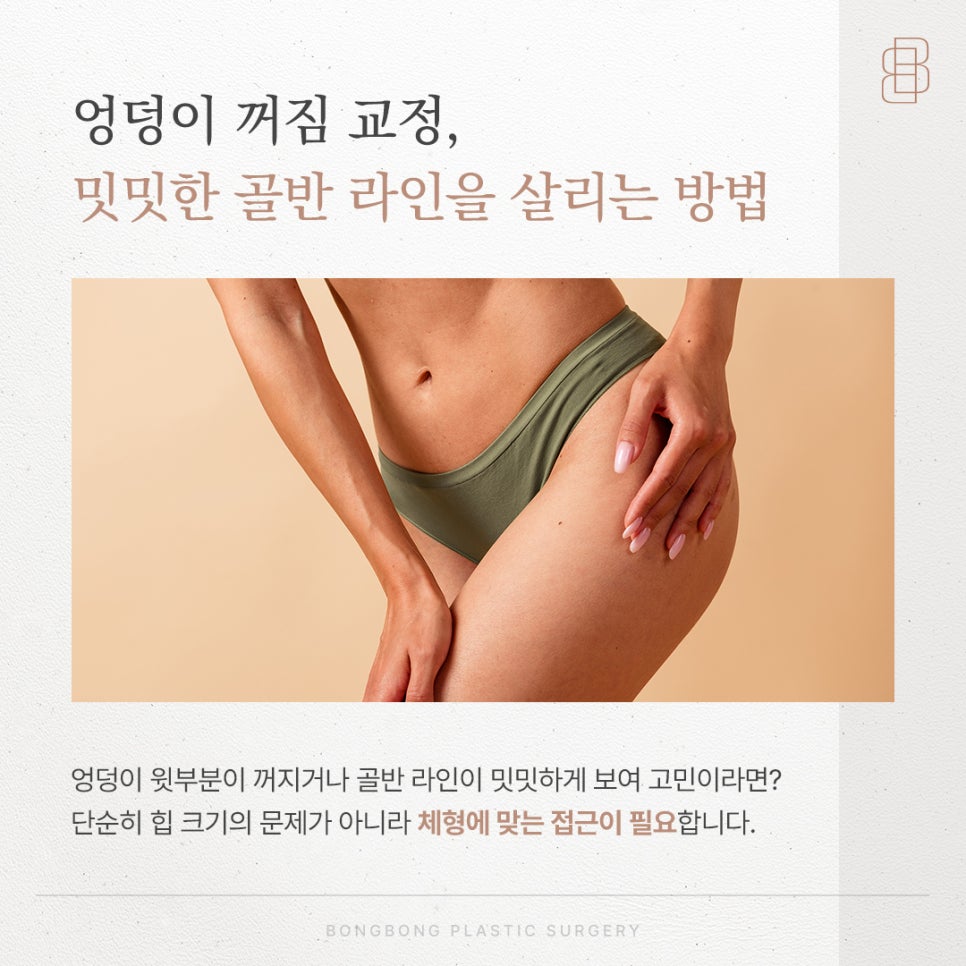 Correction of Hip Dips and Ways to Enhance a Flat Pelvic Line: Hip Augmentation Surgery image 1