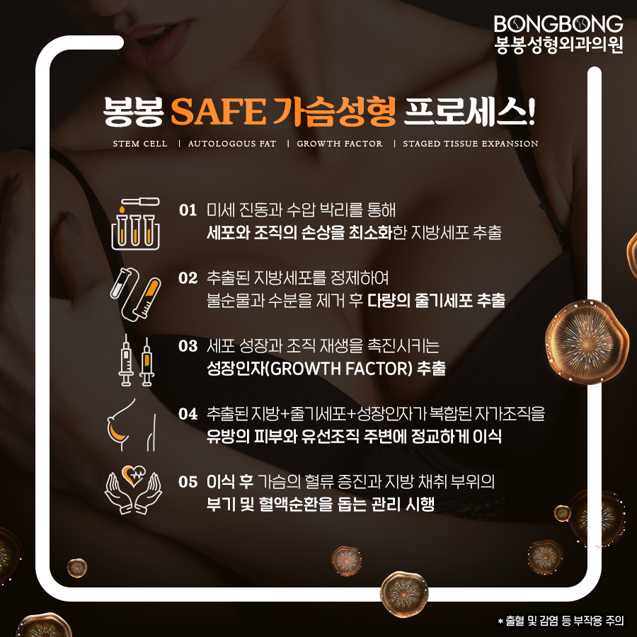 가슴볼륨 및 지방흡입 두 마리 토끼 잡을 수 있는 봉봉성형외과의 SAFE줄기세포가슴성형 관련 이미지 5