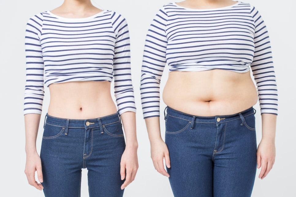 운동해도 처진 뱃살, 왜 그대로일까요? 복부성형이 고려되는 순간 관련 이미지 5