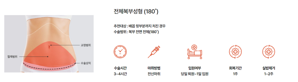 뱃살다이어트 쉽게 빼기 어렵다면 복부성형으로 해결 가능 관련 이미지 5