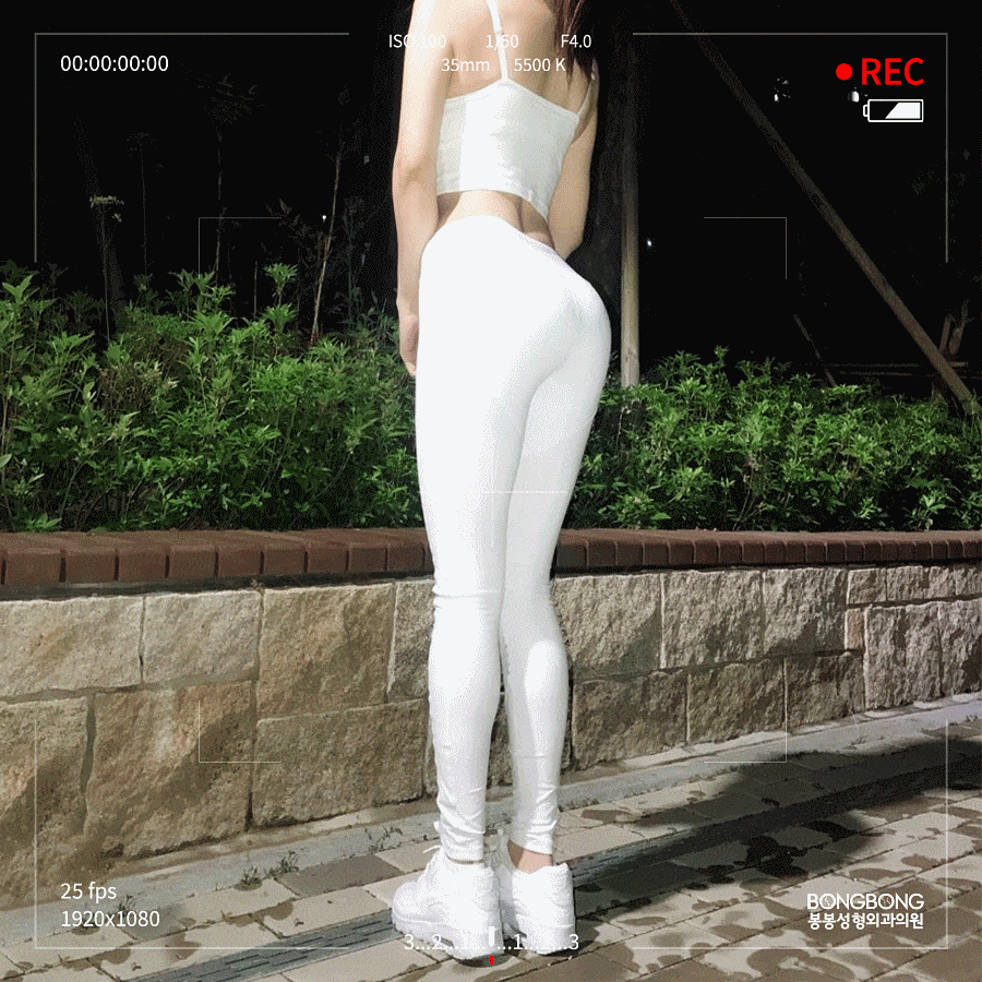 납작엉덩이 극복하는 힙업성형으로 애플힙 만들기 관련 이미지 3
