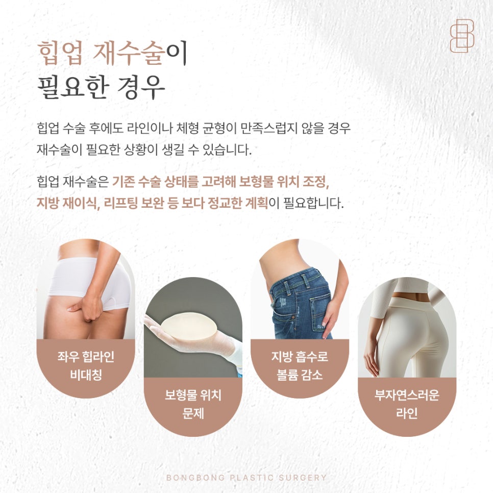 처진 엉덩이 올리기 자연스러운 힙업수술부터 정교한 재수술까지 관련 이미지 4