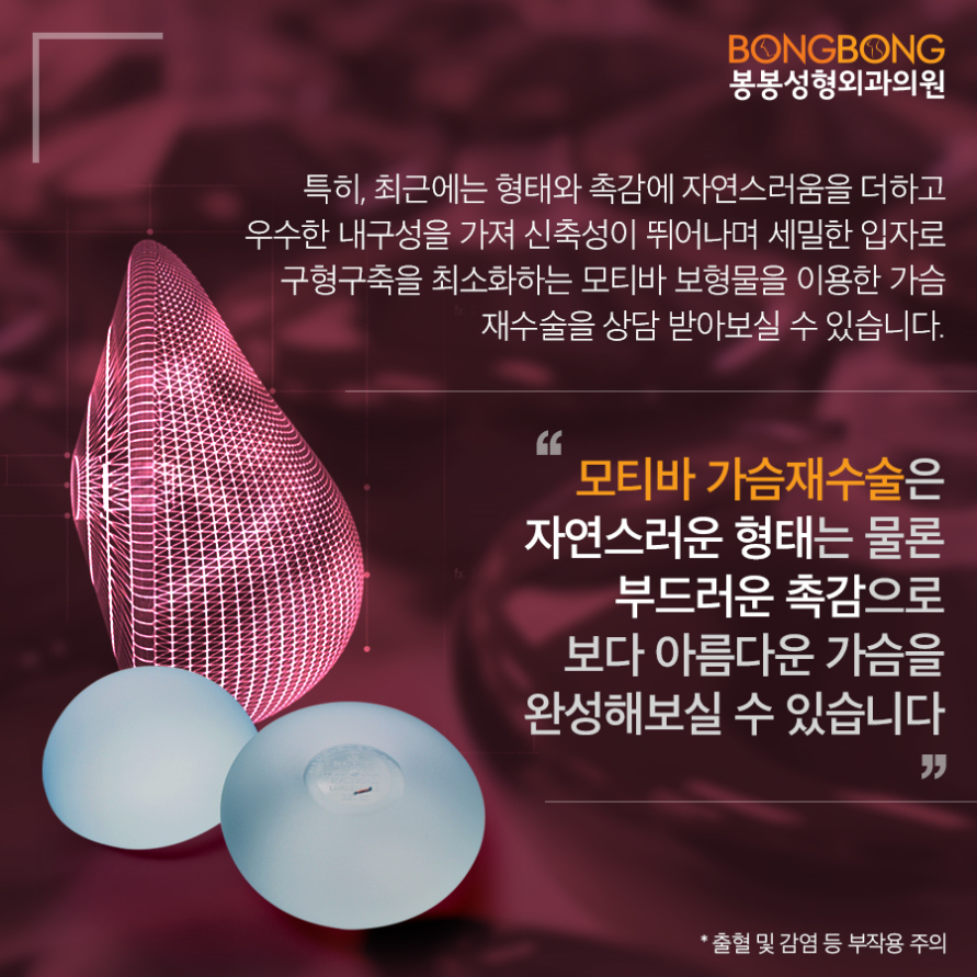 가슴재수술, 모티바 보형물이 효과적일까? - 봉봉성형외과 관련 이미지 6
