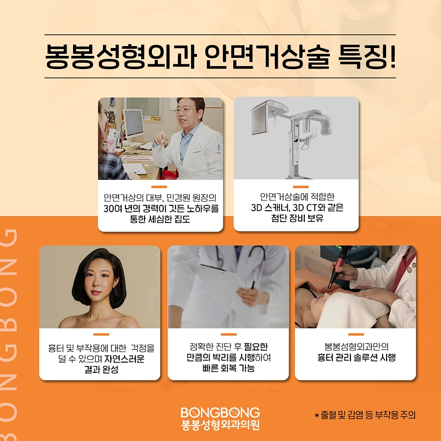 안전하면서도 만족감 높은 안면거상술 효과를 기대한다면, 관련 이미지 6