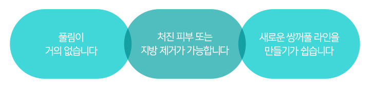 쌍커풀수술매몰법 풀릴지 고민된다면 봉봉 이중매몰법 있잖아! 관련 이미지 5